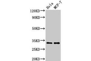 Western Blot Positive WB detected in: Hela whole cell lysate, MCF-7 whole cell lysate All lanes: HIST1H1B antibody at 1. (Histone H1.5 anticorps  (pThr154))