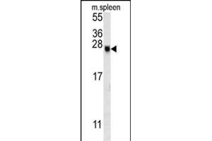 EID2 Antibody (C-term) (ABIN651820 and ABIN2840412) western blot analysis in mouse spleen tissue lysates (15 μg/lane). (EID2 anticorps  (C-Term))