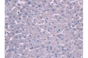 IHC-P analysis of Human Liver Tissue, with DAB staining. (PLG anticorps  (AA 274-560))