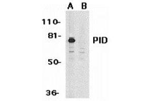 Western blot analysis of PID expression in HeLa whole cell lysates in the absence (A) or presence (B) of blocking peptide with PID antibody at 1 ug /ml. (MTA2 anticorps)