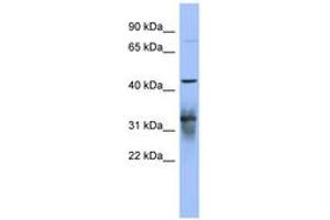 Image no. 1 for anti-Poly(A) Binding Protein, Cytoplasmic 5 (PABPC5) (AA 71-120) antibody (ABIN6743042) (PABPC5 anticorps  (AA 71-120))