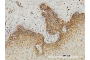 Image no. 3 for anti-Insulin Receptor-Related Receptor (INSRR) (AA 651-760) antibody (ABIN598764) (INSRR anticorps  (AA 651-760))