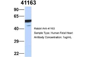 Host: Rabbit   Target Name: 41163   Sample Tissue: Human Fetal Heart  Antibody Dilution: 1. (Septin 11 anticorps  (N-Term))