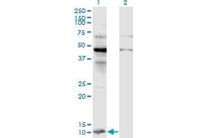 Western Blot analysis of CCL2 expression in transfected 293T cell line by CCL2 monoclonal antibody (M07), clone 2E10. (CCL2 anticorps  (AA 1-99))