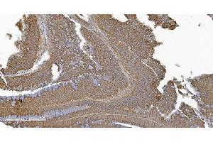 IHC analysis of PLTP using anti-PLTP antibody (ABIN7600346). (PLTP anticorps  (AA 18-470))