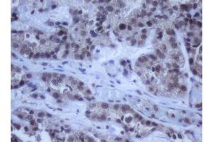 Image no. 2 for anti-DEAD (Asp-Glu-Ala-Asp) Box Polypeptide 59 (DDX59) (AA 1-303) antibody (ABIN1490728) (DDX59 anticorps  (AA 1-303))