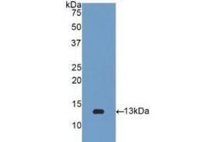 WB of Protein Standard: different control antibodies against Highly purified E. (beta-2 Microglobulin Kit CLIA)