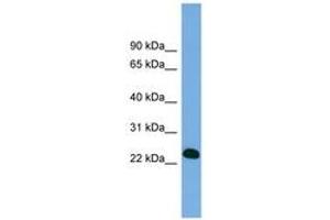 Image no. 1 for anti-B-Cell CLL/lymphoma 7A (BCL7A) (AA 71-120) antibody (ABIN6743279) (BCL7A anticorps  (AA 71-120))