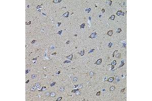 Immunohistochemistry of paraffin-embedded rat brain using HMMR antibody.