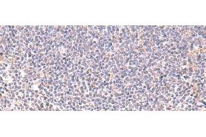 Immunohistochemistry of paraffin-embedded Human tonsil tissue using DHPS Polyclonal Antibody at dilution of 1:75(x200) (DHPS anticorps)
