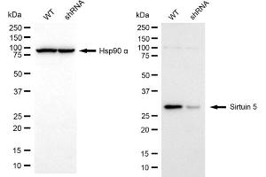 Western blotting analysis using sirtuin 5 antibody (ABIN7800355).