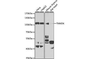 Western blot analysis of extracts of various cell lines, using TNNI3K antibody (ABIN6132847, ABIN6149361, ABIN6149362 and ABIN6223764) at 1:1000 dilution. (TNNI3K anticorps  (AA 1-75))