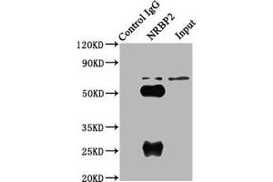 Immunoprecipitating NRBP2 in A549 whole cell lysate Lane 1: Rabbit control IgG (1 μg) instead of ABIN7161918 in A549 whole cell lysate. (NRBP2 anticorps  (AA 12-258))