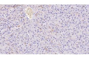 Detection of APOH in Human Liver Tissue using Monoclonal Antibody to Apolipoprotein H (APOH)