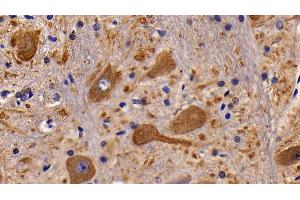 Detection of CHRM1 in Rat Spinal cord Tissue using Polyclonal Antibody to Cholinergic Receptor, Muscarinic 1 (CHRM1) (CHRM1 anticorps  (AA 210-363))
