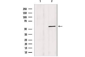 Western blot analysis of extracts from mouse brain, using BBS4 antibody. (BBS4 anticorps  (Internal Region))