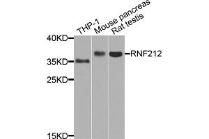 Western blot analysis of extracts of various cell lines, using RNF212 antibody (ABIN5971848) at 1/1000 dilution. (RNF212 anticorps)