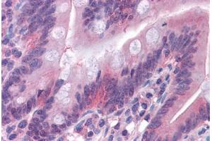 Human Small Intestine: Formalin-Fixed, Paraffin-Embedded (FFPE) (GSDMD anticorps  (AA 1-485))