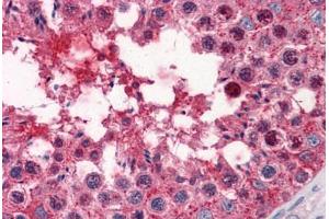 Human Testis: Formalin-Fixed, Paraffin-Embedded (FFPE) (Glycogenin 1 anticorps  (AA 1-74))