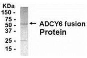 Western Blotting (WB) image for anti-Adenylate Cyclase 6 (ADCY6) (AA 1-121) antibody (ABIN2467944) (ADCY6 anticorps  (AA 1-121))