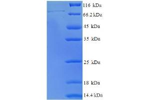 SDS-PAGE (SDS) image for Polymerase (RNA) III (DNA Directed) Polypeptide C (62kD) (POLR3C) (AA 1-534), (full length) protein (His-SUMO Tag) (ABIN5711825)