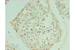 Immunohistochemistry of paraffin-embedded human testis tissue using ABIN7175475 at dilution of 1:100
