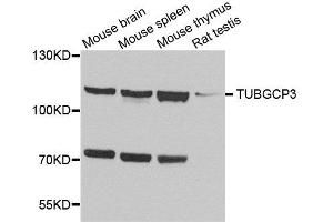 Western blot analysis of extracts of various cell lines, using TUBGCP3 antibody. (TUBGCP3 anticorps  (AA 1-250))
