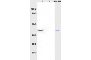 Lane 1: rat brain lysates Lane 2: rat kidney lysates probed with Anti GNAQ/G?