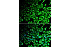Immunofluorescence analysis of HeLa cells using DPP7 antibody (ABIN5973952). (DPP7 anticorps)