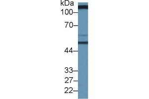 Detection of SLC3A2 in Human Serum using Polyclonal Antibody to Solute Carrier Family 3, Member 2 (SLC3A2)