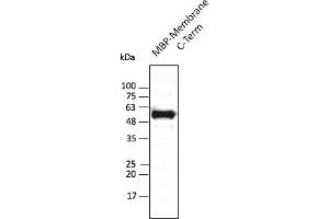 Western Blotting (WB) image for anti-SARS-CoV-2 Membrane Protein (SARS-CoV-2 M) (C-Term) antibody (ABIN7273010) (SARS-CoV-2 Membrane Protein anticorps  (C-Term))