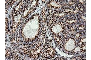 Image no. 5 for anti-Prostaglandin E Synthase 2 (PTGES2) antibody (ABIN1500491) (PTGES2 anticorps)