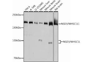 anti-Wolf-Hirschhorn Syndrome Candidate 1-Like 1 (WHSC1L1) antibody