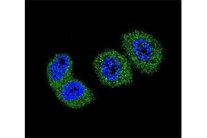 Confocal immunofluorescent analysis of FOXO3 antibody with MCF-7 cells followed by Alexa Fluor 488-conjugated goat anti-rabbit lgG (green).