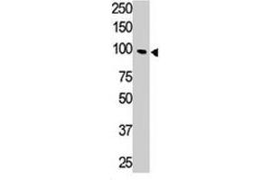 The Tlr5 polyclonal antibody  is used in Western blot to detect TLR5 in HL-60 cell lysate. (TLR5 anticorps  (N-Term))