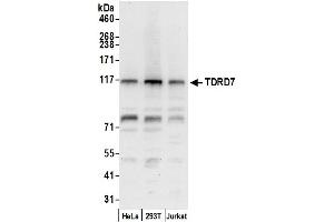 anti-Tudor Domain Containing 7 (TDRD7) (AA 1048-1098) antibody