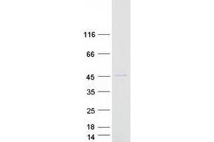 Validation with Western Blot