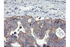 Image no. 2 for anti-Phosphatidylinositol-4-Phosphate 3-Kinase, Catalytic Subunit Type 2 beta (PIK3C2B) antibody (ABIN1500198)