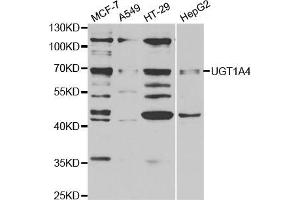 Western blot analysis of extracts of various cell lines, using μgT1A4 antibody (ABIN5973231) at 1/1000 dilution. (UGT1A4 anticorps)