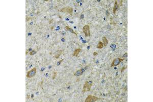 Immunohistochemistry of paraffin-embedded mouse spinal cord using TXN2 antibody. (TXN2 anticorps)