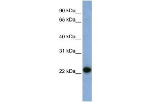 WB Suggested Anti-CAV1 Antibody Titration:  0. (Caveolin-1 anticorps  (N-Term))