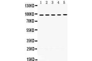 Western Blotting (WB) image for anti-Minichromosome Maintenance Deficient 8 (MCM8) (AA 809-840), (C-Term) antibody (ABIN3042508) (MCM8 anticorps  (C-Term))