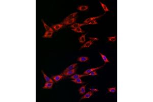 Immunofluorescence analysis of NIH-3T3 cells using OP antibody (ABIN6129426, ABIN6145031, ABIN6145032 and ABIN6225150) at dilution of 1:100 (40x lens).