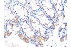 Immunohistochemistry of paraffin-embedded mouse colon using MUC2 Rabbit mAb (ABIN7268689) at dilution of 1:100 (40x lens). (MUC2 anticorps)