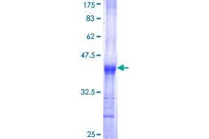 Image no. 1 for UDP-Glucose 6-Dehydrogenase (UGDH) (AA 395-494) protein (GST tag) (ABIN1324563)