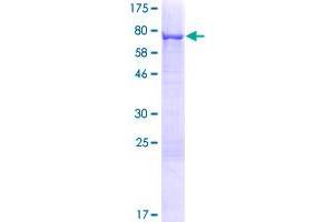 Image no. 1 for Keratin 71 (KRT71) (AA 1-523) protein (GST tag) (ABIN1309022)