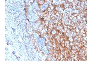 Formalin-fixed, paraffin-embedded human tonsil stained with CD11b Monospecific Mouse Monoclonal Antibody (ITGAM/3337).