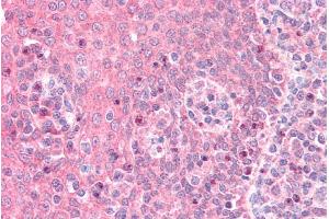 ABIN5539638 (5µg/ml) staining of paraffin embedded Human Tonsil.