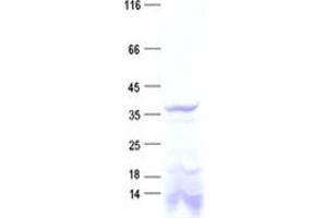 Validation with Western Blot