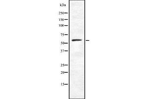 Western blot analysis of CARD9 using K562 whole cell lysates (CARD9 anticorps  (C-Term))